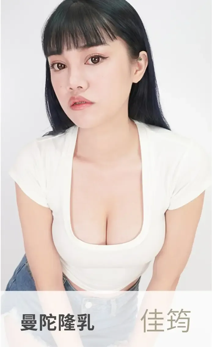 案例4